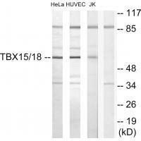 TBX15/18