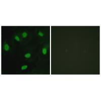 Rabbit Polyclonal Antibody to TBX15/18
