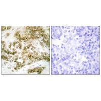 Rabbit Polyclonal Antibody to TBX15/18