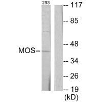 MOS