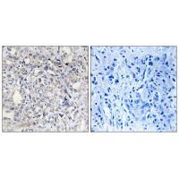 Rabbit Polyclonal Antibody to Heparin Cofactor II