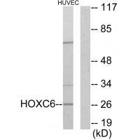 HOXC6
