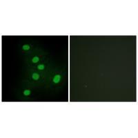 Rabbit Polyclonal Antibody to NR2F6
