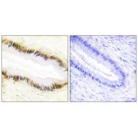 Rabbit Polyclonal Antibody to NR2F6