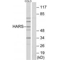 HARS