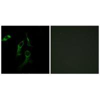 Rabbit Polyclonal Antibody to HARS
