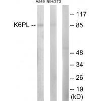 K6PL
