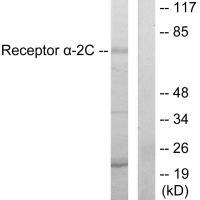 Adrenergic Receptor α-2C