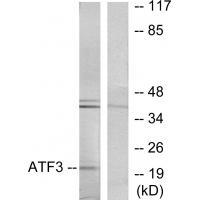 ATF3