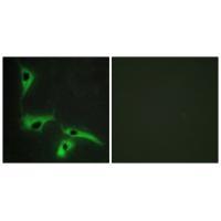 Rabbit Polyclonal Antibody to TSPAN8