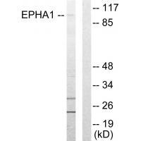 EPHA1