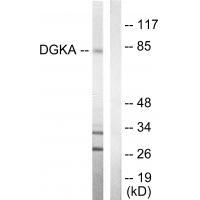 DGKA