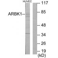 ARBK1