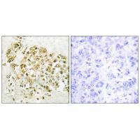 Rabbit Polyclonal Antibody to MZF-1