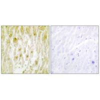 Rabbit Polyclonal Antibody to TF2E2
