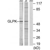 GLPK