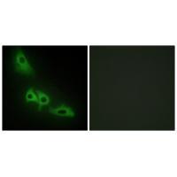 Rabbit Polyclonal Antibody to GLPK