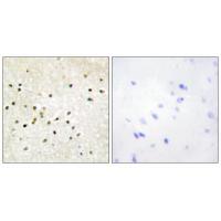 Rabbit Polyclonal Antibody to TF2H1
