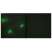 Rabbit Polyclonal Antibody to CSTF2