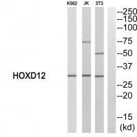HOXD12