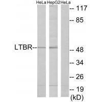 LTBR