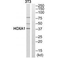 HOXA1