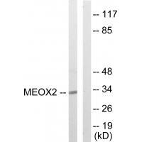 MEOX2