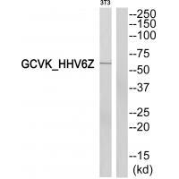 GCVK_HHV6Z