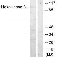 Hexokinase-3
