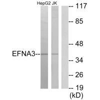 EFNA3