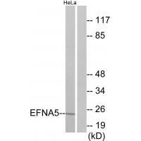 EFNA5