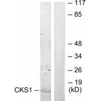 CKS1