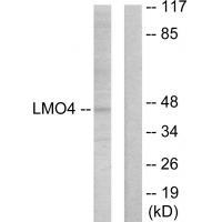 LMO4