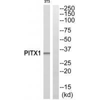 PITX1
