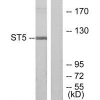 ST5