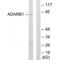 ADARB1