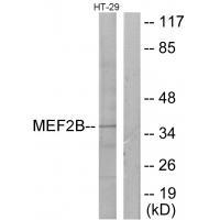 MEF2B