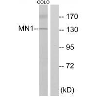 MN1
