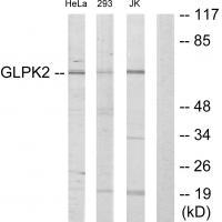 GLPK2