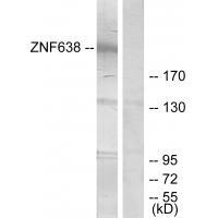 ZNF638