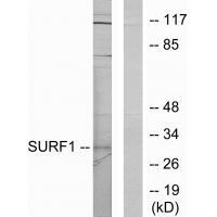 SURF1