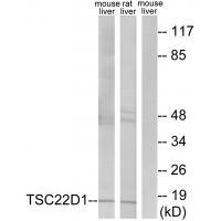 TSC22D1