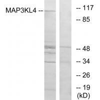 MAP3KL4