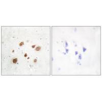 Rabbit Polyclonal Antibody to CaMK1-β