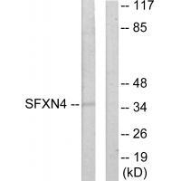 SFXN4
