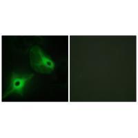 Rabbit Polyclonal Antibody to KSR2