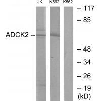 ADCK2