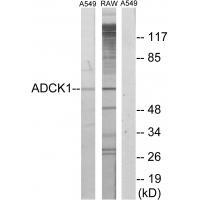 ADCK1