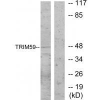 TRIM59
