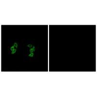 CKI-α1/L